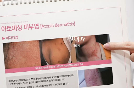 생기한의원이 정리한 성인 아토피 생활환경 점검 포인트